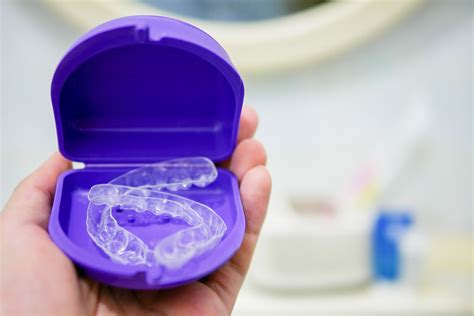 Retainers: Pros, Cons, and Costs for Each Type .